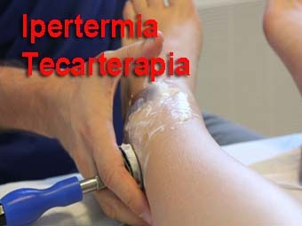 Diatermia TECARTERAPIA 001 spine center